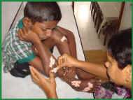 Vinitha verarztet Gayans viele Schuerfwunden vom Toben im Chathura-Kinderheim in Sri Lanka 